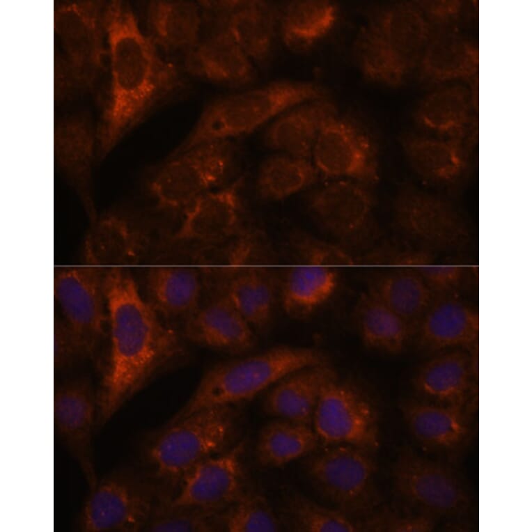 Immunofluorescence - Anti-HEBP2 Antibody (A88889) - Antibodies.com