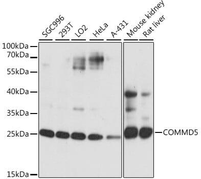 Western blot analysis of extracts of various cell lines, using Anti-COMMD5 Antibody (A16518) at 1:1,000 dilution.
Secondary antibody: Goat Anti-Rabbit IgG (H+L) (HRP) (AS014) at 1:10,000 dilution.
Lysates / proteins: 25µg per lane.
Blocking buffer: 3% non-fat dry milk in TBST.
Detection: ECL Basic Kit (RM00020).
Exposure time: 1s.