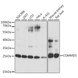 Western Blot - Anti-COMMD5 Antibody (A88890) - Antibodies.com