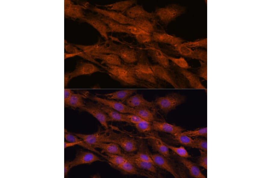 Immunofluorescence - Anti-COMMD5 Antibody (A88890) - Antibodies.com