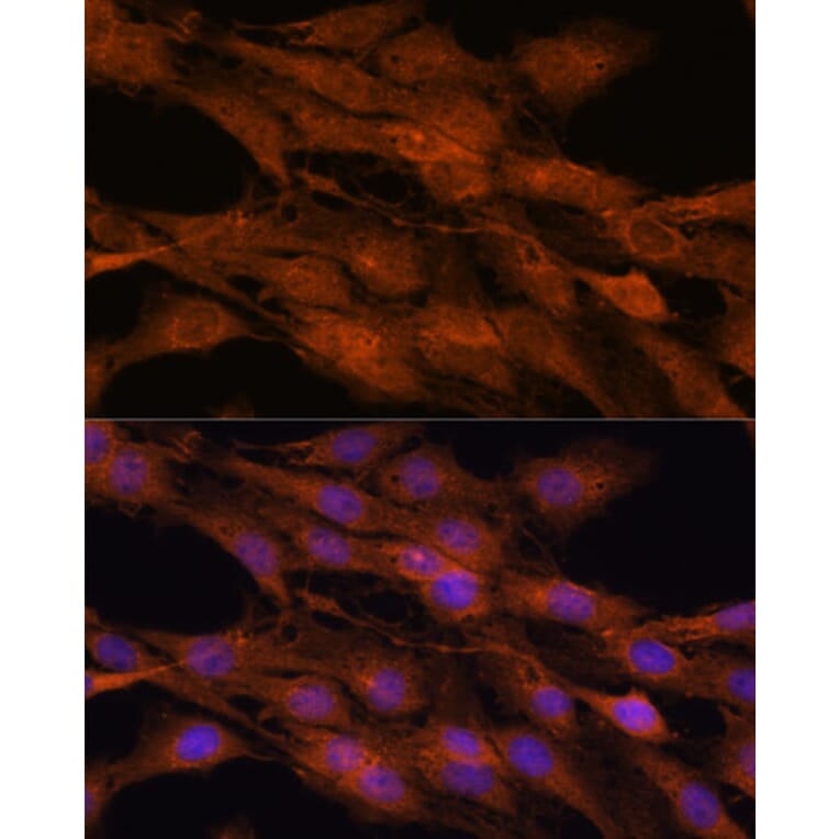 Immunofluorescence - Anti-COMMD5 Antibody (A88890) - Antibodies.com