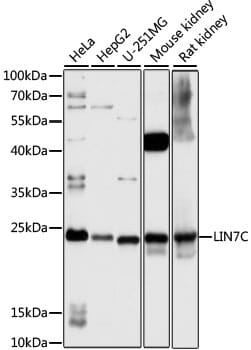 Western blot analysis of extracts of various cell lines, using Anti-LIN7C Antibody (A16544) at 1:1,000 dilution.
Secondary antibody: Goat Anti-Rabbit IgG (H+L) (HRP) (AS014) at 1:10,000 dilution.
Lysates / proteins: 25µg per lane.
Blocking buffer: 3% non-fat dry milk in TBST.
Detection: ECL Basic Kit (RM00020).
Exposure time: 3s.