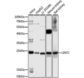 Western Blot - Anti-LIN7 Antibody (A88891) - Antibodies.com