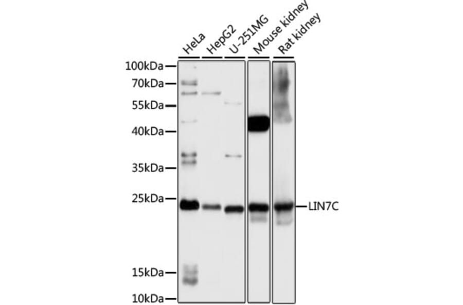 Western Blot - Anti-LIN7 Antibody (A88891) - Antibodies.com