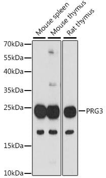Western blot analysis of extracts of various cell lines, using Anti-PRG3 Antibody (A16481) at 1:1,000 dilution.
Secondary antibody: Goat Anti-Rabbit IgG (H+L) (HRP) (AS014) at 1:10,000 dilution.
Lysates / proteins: 25µg per lane.
Blocking buffer: 3% non-fat dry milk in TBST.
Detection: ECL Basic Kit (RM00020).
Exposure time: 90s.