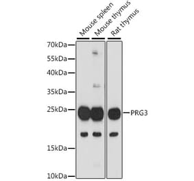 Western Blot - Anti-PRG3 Antibody (A88892) - Antibodies.com