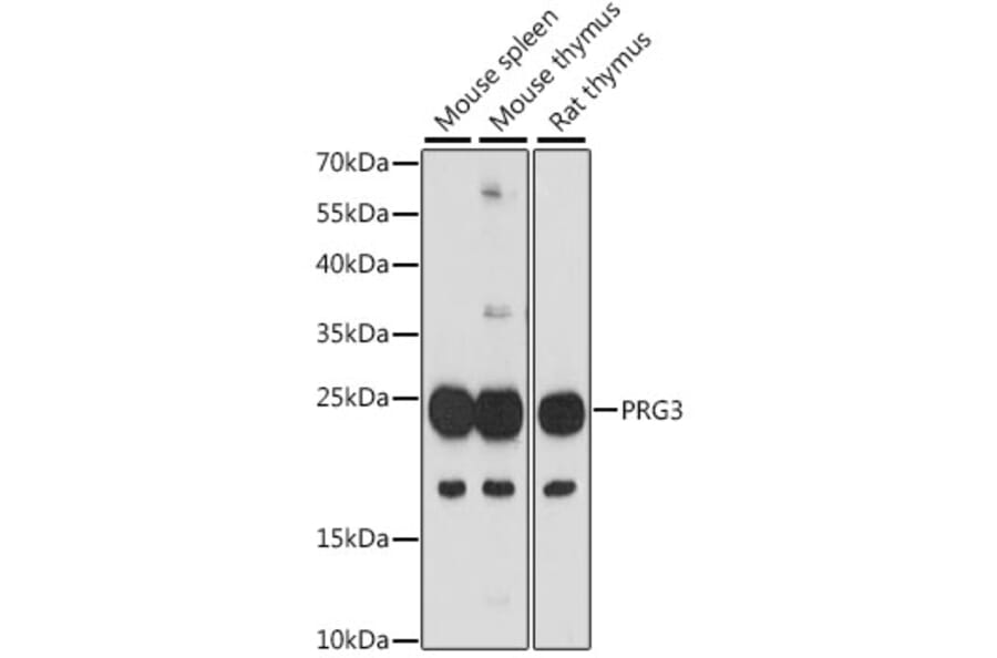 Western Blot - Anti-PRG3 Antibody (A88892) - Antibodies.com