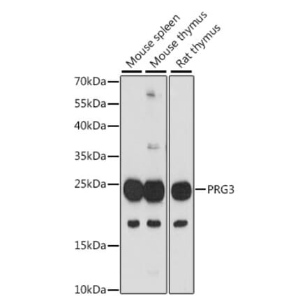 Western Blot - Anti-PRG3 Antibody (A88892) - Antibodies.com