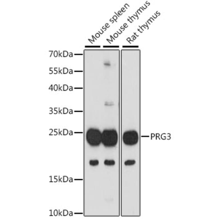 Western Blot - Anti-PRG3 Antibody (A88892) - Antibodies.com