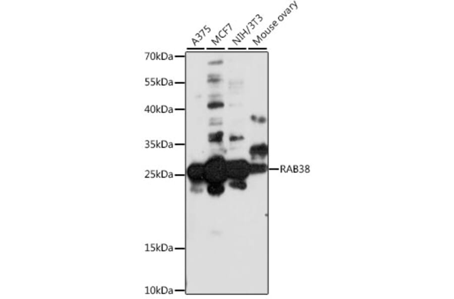 Western Blot - Anti-RAB38 Antibody (A88893) - Antibodies.com