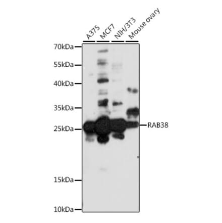 Western Blot - Anti-RAB38 Antibody (A88893) - Antibodies.com