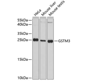 Western Blot - Anti-GSTM3 Antibody (A88894) - Antibodies.com