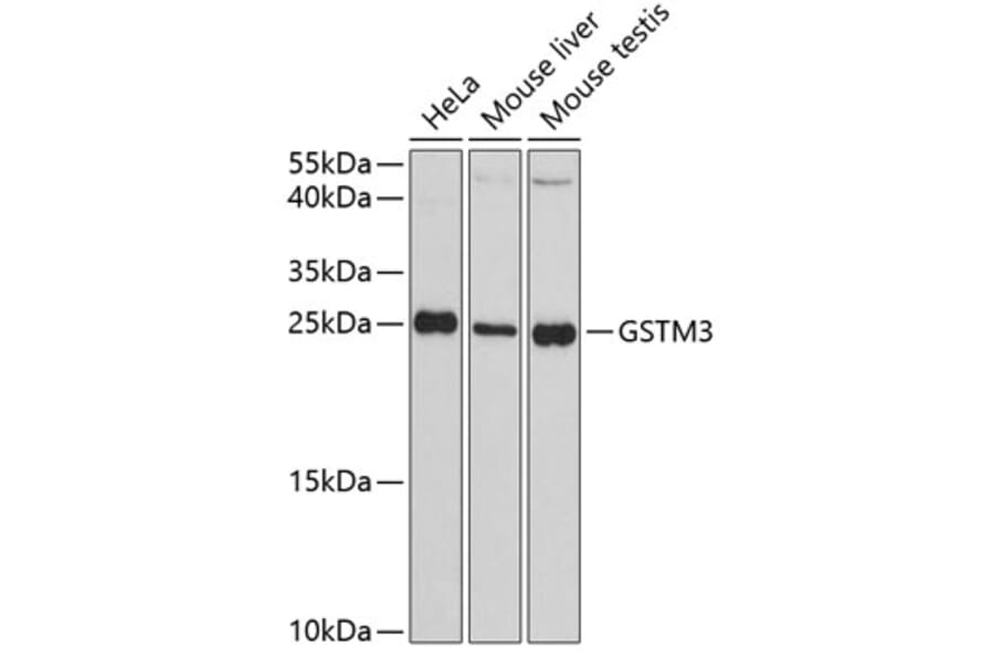 Western Blot - Anti-GSTM3 Antibody (A88894) - Antibodies.com