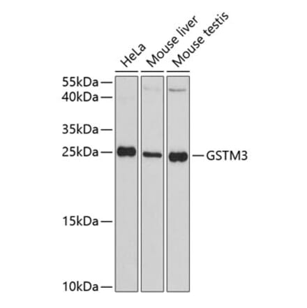 Western Blot - Anti-GSTM3 Antibody (A88894) - Antibodies.com