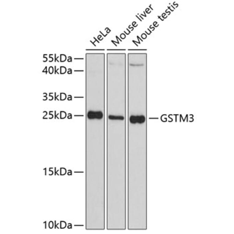 Western Blot - Anti-GSTM3 Antibody (A88894) - Antibodies.com