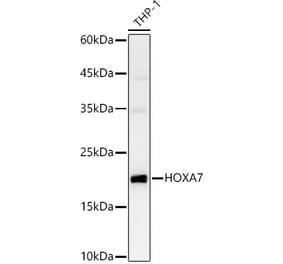 Western Blot - Anti-HOXA7 Antibody (A88895) - Antibodies.com