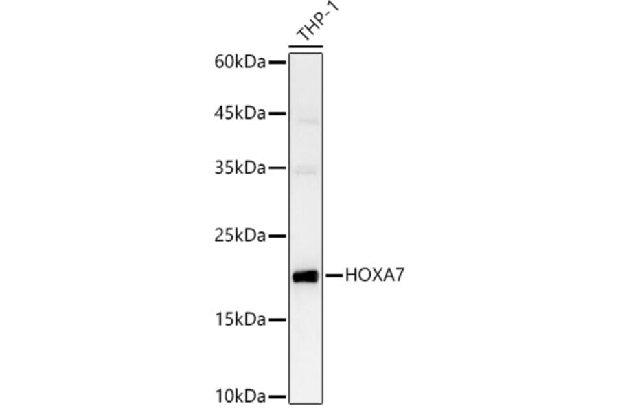 Western Blot - Anti-HOXA7 Antibody (A88895) - Antibodies.com