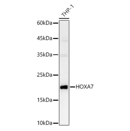 Western Blot - Anti-HOXA7 Antibody (A88895) - Antibodies.com