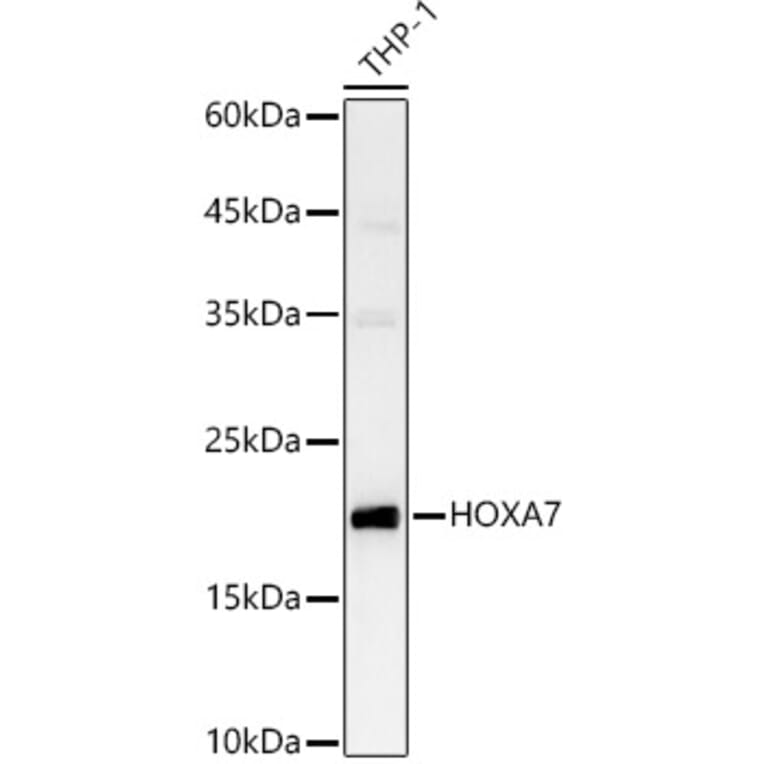 Western Blot - Anti-HOXA7 Antibody (A88895) - Antibodies.com