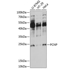 Western Blot - Anti-PCNP Antibody (A88896) - Antibodies.com