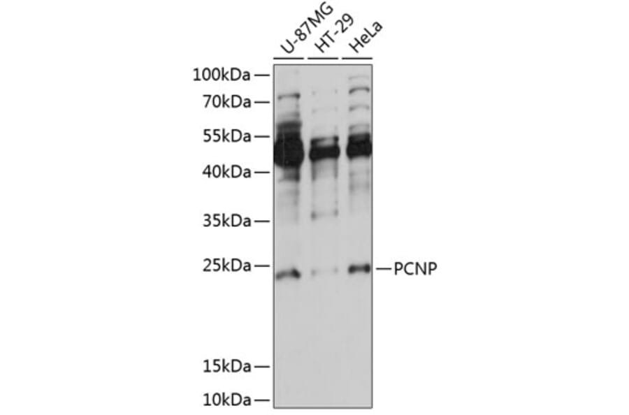 Western Blot - Anti-PCNP Antibody (A88896) - Antibodies.com