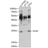 Western Blot - Anti-PCNP Antibody (A88896) - Antibodies.com