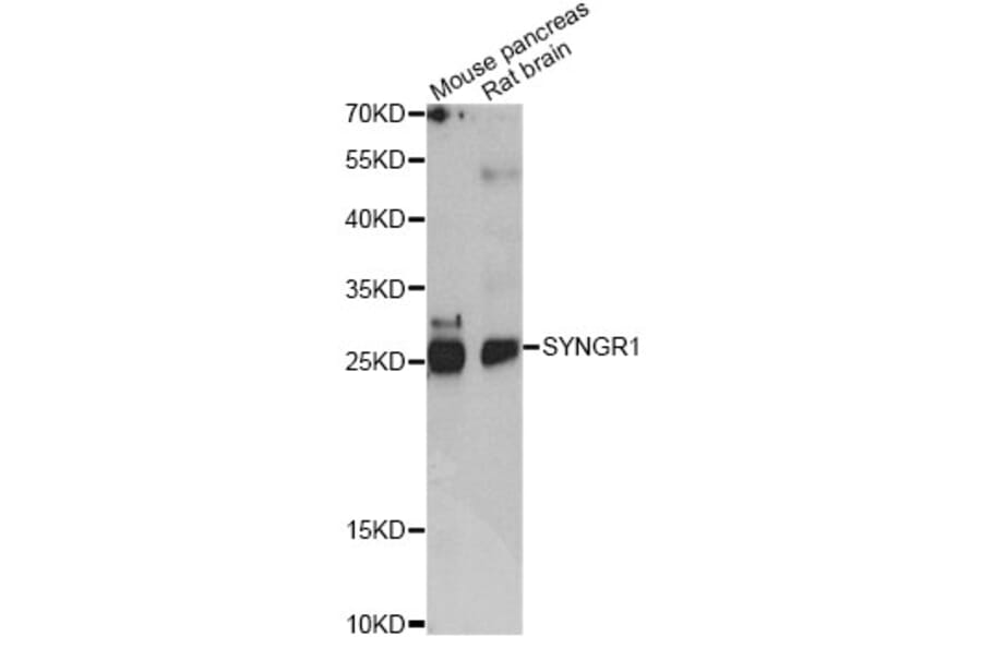 Western Blot - Anti-SYNGR1 Antibody (A14087) - Antibodies.com