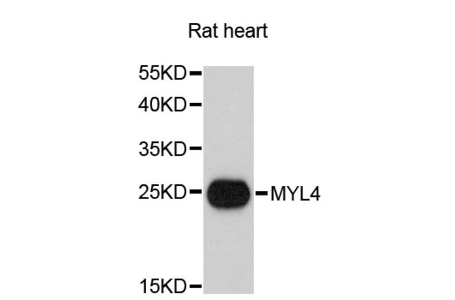 Western Blot - Anti-MYL4 Antibody (A13031) - Antibodies.com