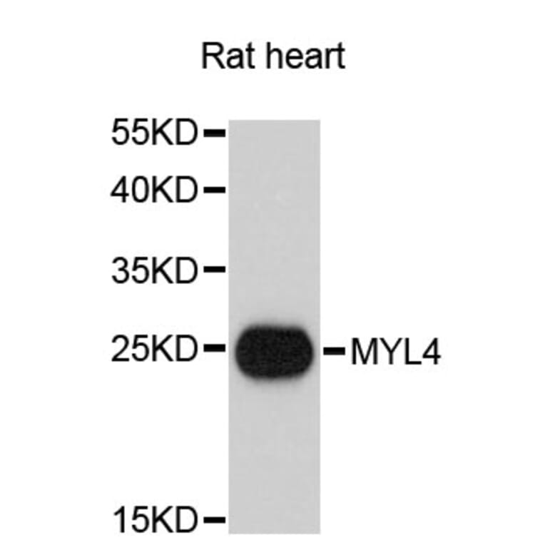 Western Blot - Anti-MYL4 Antibody (A13031) - Antibodies.com