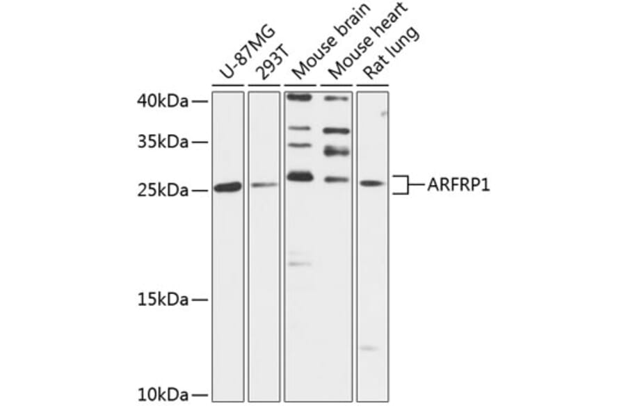 Western Blot - Anti-ARFRP1 Antibody (A88899) - Antibodies.com
