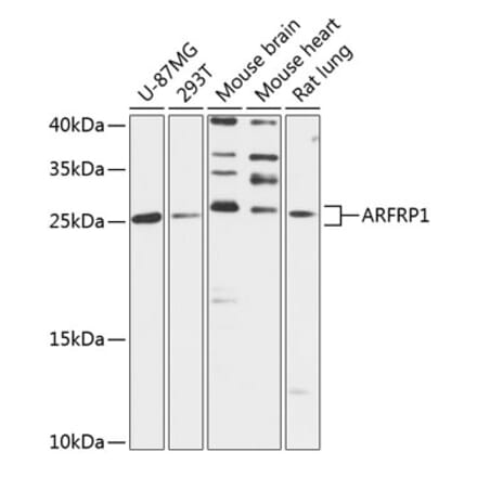 Western Blot - Anti-ARFRP1 Antibody (A88899) - Antibodies.com