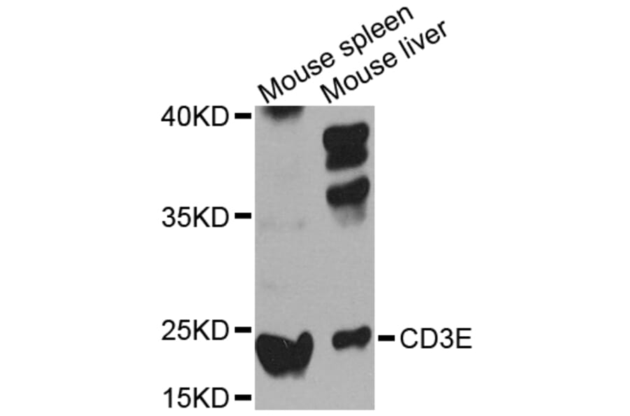 Western Blot - Anti-CD3E Antibody (A12413) - Antibodies.com