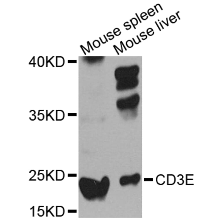Western Blot - Anti-CD3E Antibody (A12413) - Antibodies.com