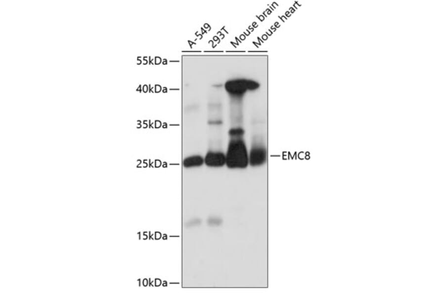 Western Blot - Anti-COX4NB Antibody (A88901) - Antibodies.com