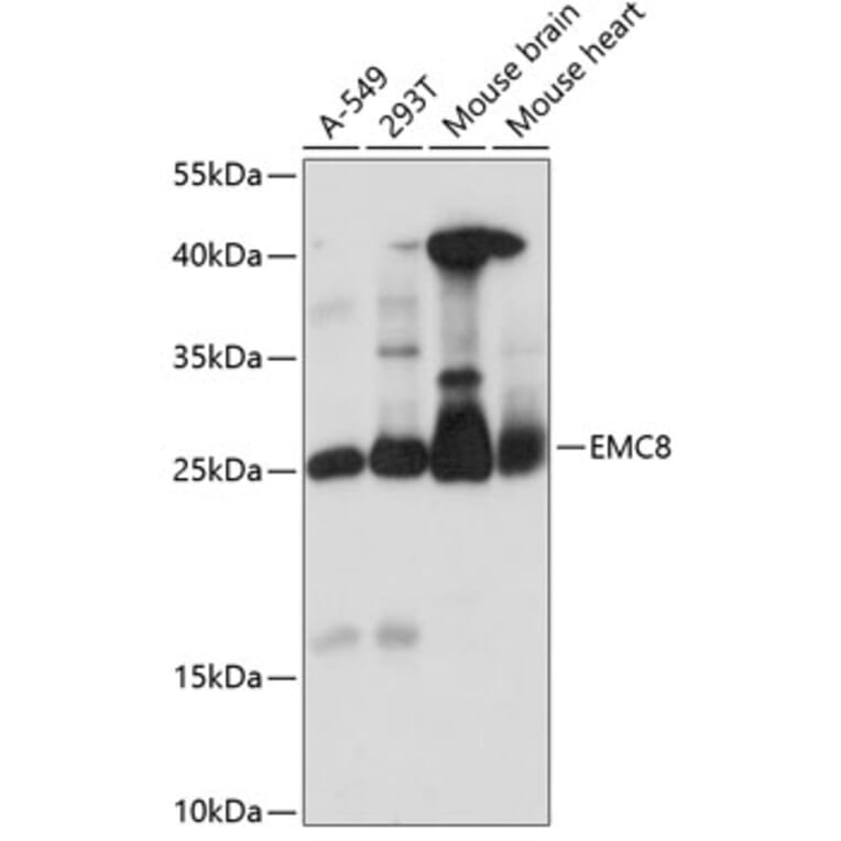 Western Blot - Anti-COX4NB Antibody (A88901) - Antibodies.com