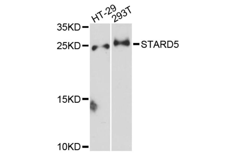 Western Blot - Anti-STARD5 Antibody (A13901) - Antibodies.com