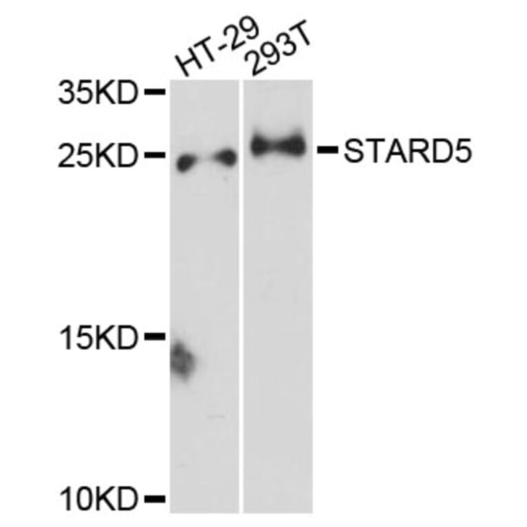 Western Blot - Anti-STARD5 Antibody (A13901) - Antibodies.com