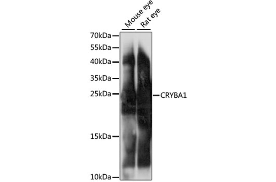 Western Blot - Anti-beta Crystallin A3 Antibody (A88903) - Antibodies.com