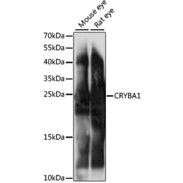 Western Blot - Anti-beta Crystallin A3 Antibody (A88903) - Antibodies.com