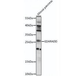 Western Blot - Anti-EDARADD Antibody (A88904) - Antibodies.com