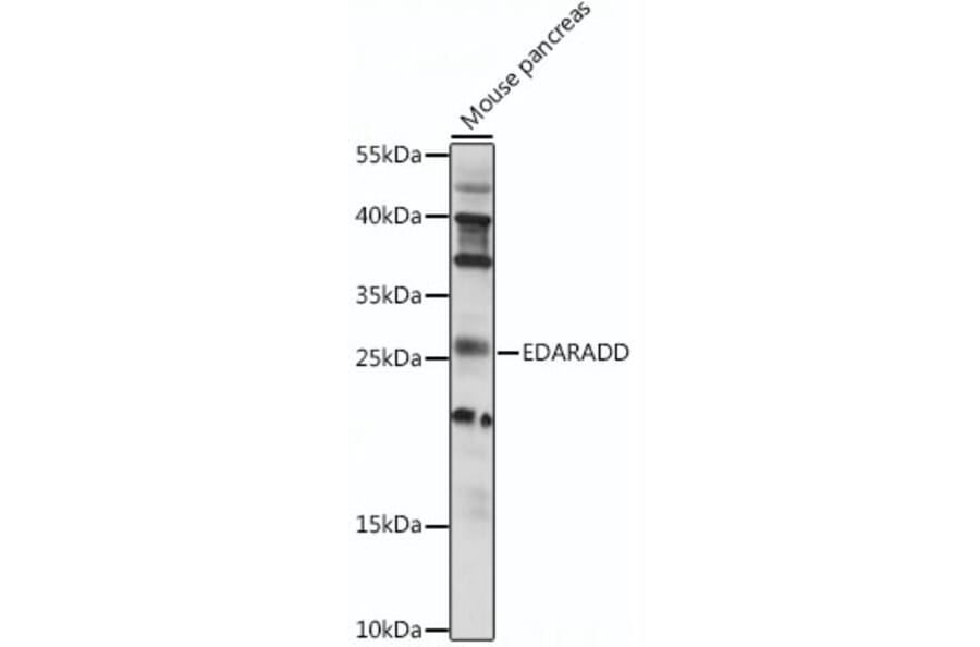 Western Blot - Anti-EDARADD Antibody (A88904) - Antibodies.com