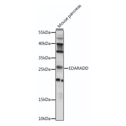 Western Blot - Anti-EDARADD Antibody (A88904) - Antibodies.com