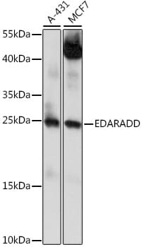 Western blot analysis of extracts of various cell lines, using Anti-EDARADD Antibody (A15950) at 1:1,000 dilution.
Secondary antibody: Goat Anti-Rabbit IgG (H+L) (HRP) (AS014) at 1:10,000 dilution.
Lysates / proteins: 25µg per lane.
Blocking buffer: 3% non-fat dry milk in TBST.
Detection: ECL Basic Kit (RM00020).
Exposure time: 60s.