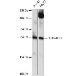 Western Blot - Anti-EDARADD Antibody (A88905) - Antibodies.com