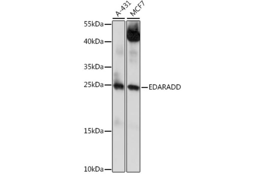 Western Blot - Anti-EDARADD Antibody (A88905) - Antibodies.com