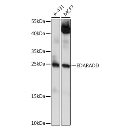 Western Blot - Anti-EDARADD Antibody (A88905) - Antibodies.com