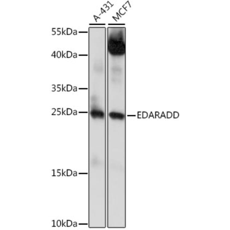 Western Blot - Anti-EDARADD Antibody (A88905) - Antibodies.com