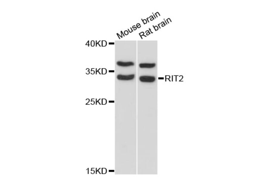 Western Blot - Anti-RIT2 Antibody (A13043) - Antibodies.com