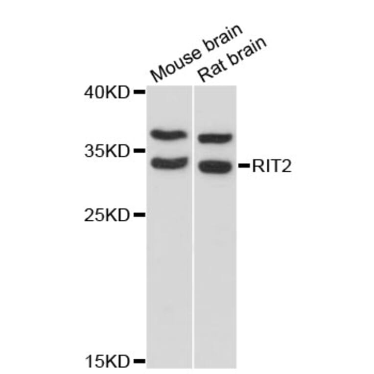 Western Blot - Anti-RIT2 Antibody (A13043) - Antibodies.com