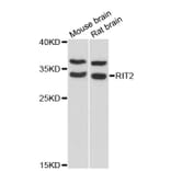 Western Blot - Anti-RIT2 Antibody (A13043) - Antibodies.com